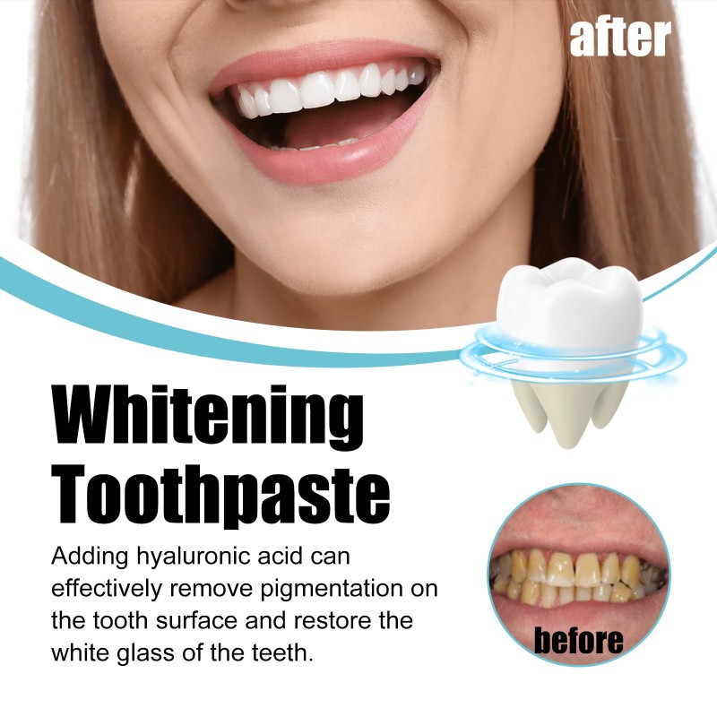 Toothpaste Manufacturer - Hyaluronic Acid Whitening 100ml