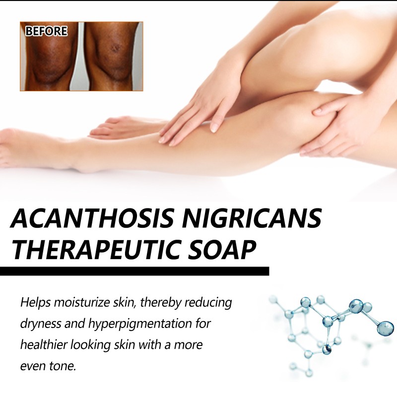 Whitening Soap Supplier - Bamboo Charcoal Armpit Bleaching 100g