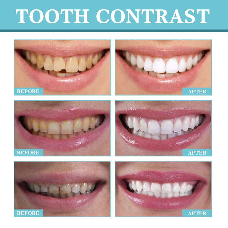 Mouthwash Supplier - Travel Size Vanilla Mint 15ml