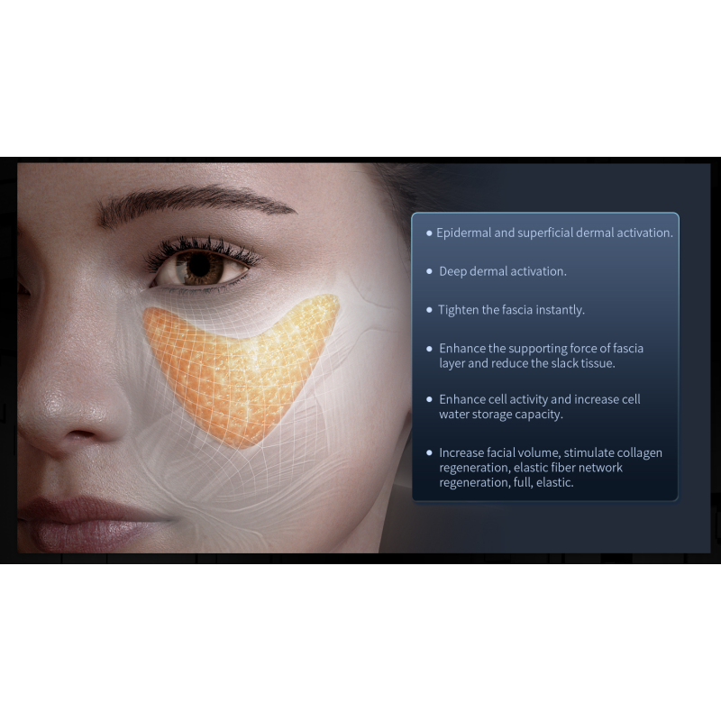 Beauty Machine Supplier - 12D MAX Face Lifting Device