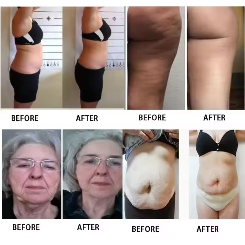 Red Light Therapy Machine Manufacturer - 5D Lipo Laser Belt