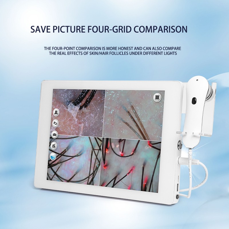 Skin Analyzer Machine Manufacturer - HD Scalp Detection