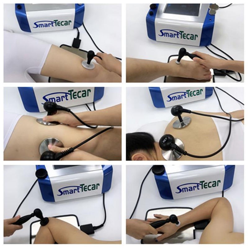 Smart Tecar Machine Factory - CET RET Diathermy Therapy