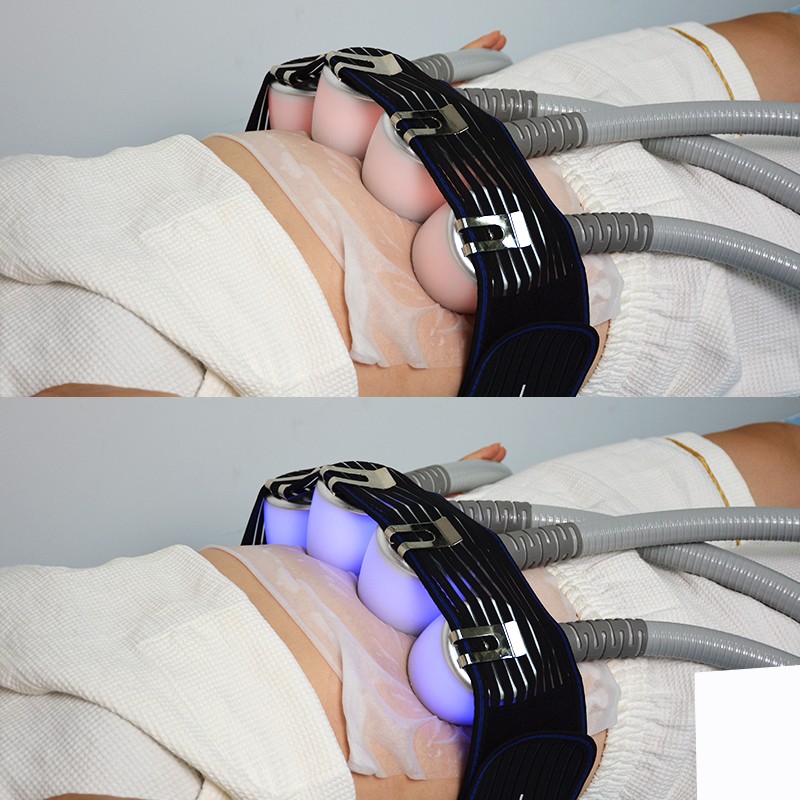 Cryo Balloon Machine Supplier - Cryoskin Revolution Massage