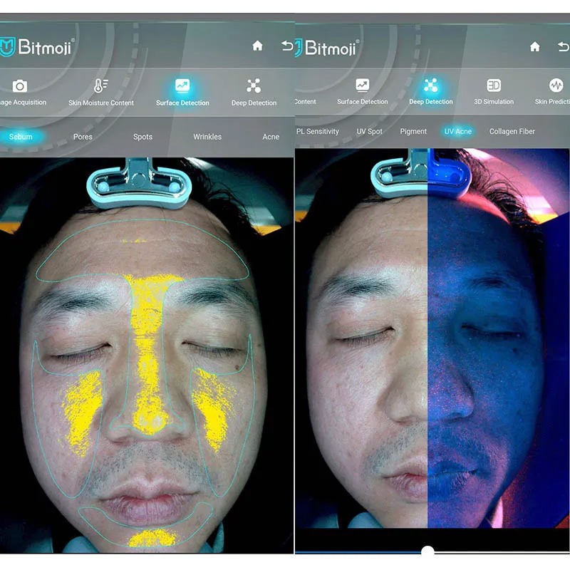 AI Face Analyzer Manufacturer - Portable Skin Tester
