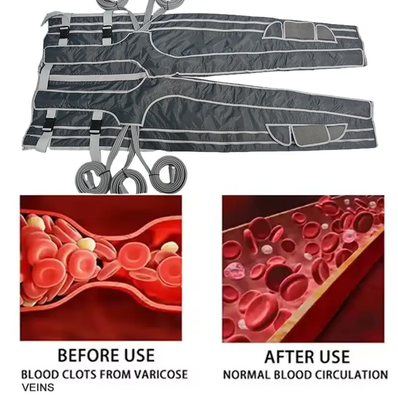 Lymphatic Drainage Machine Supplier - 24 Air Bag Pressotherapy