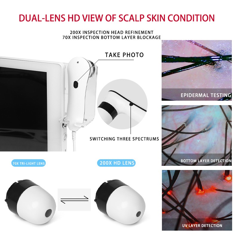 Skin Analyzer Machine Manufacturer - HD Scalp Detection