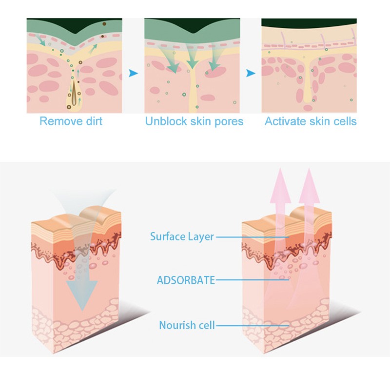 Hydrodermabrasion Machine Factory - 3in1 Exfoliation Therapy