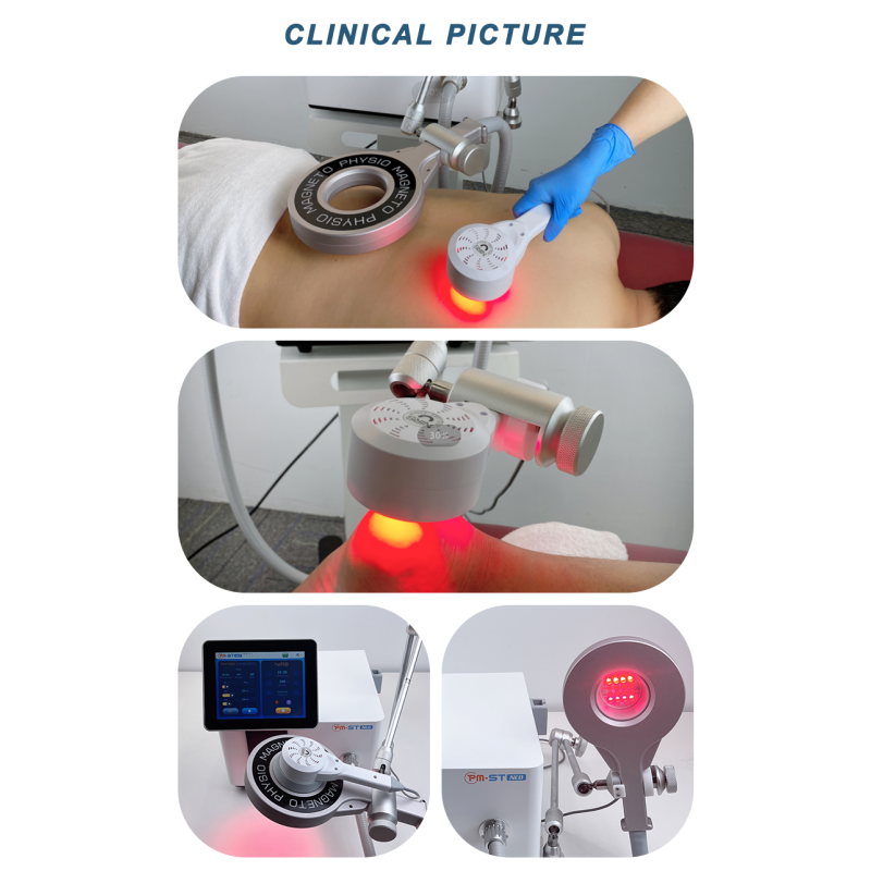 Magnetic Therapy Device Supplier - Pulsed Equine Therapy