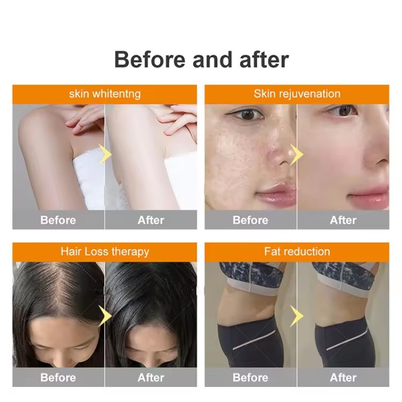 Red Light Therapy Machine Supplier - Tanning Bed Beauty Device