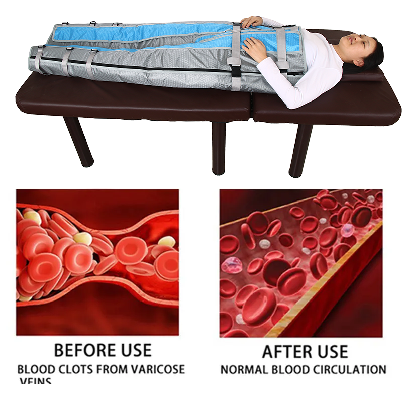 Pressotherapy Machine Factory - Lymphatic Drainage Slimming