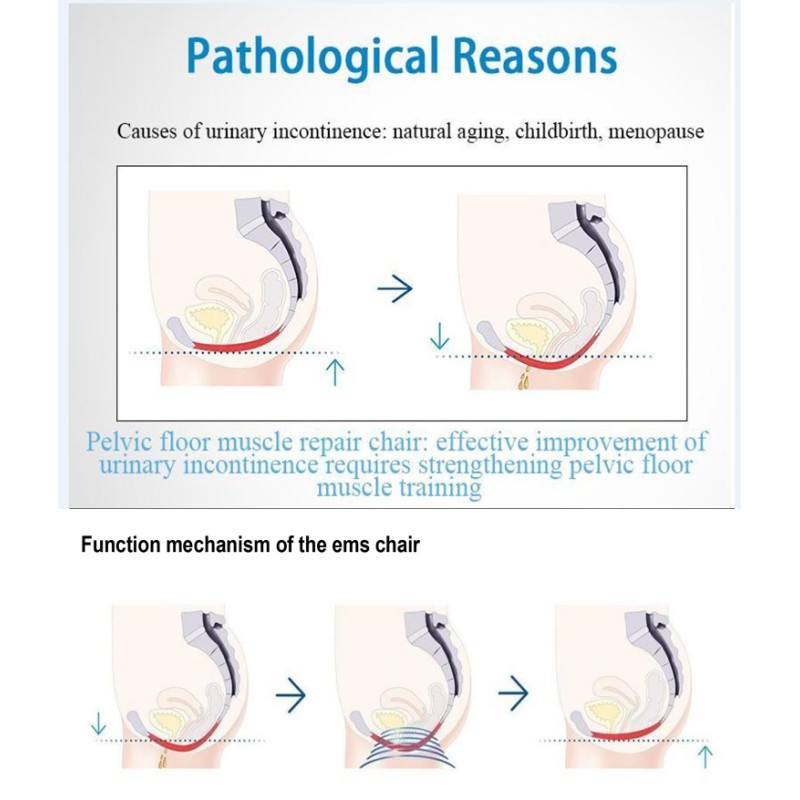 EMS Chair Machine Manufacturer - Muscle Stimulation Therapy