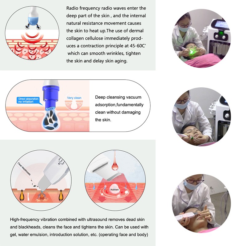 Hydrodermabrasion Machine Manufacturer - 6in1 Aqua Peel