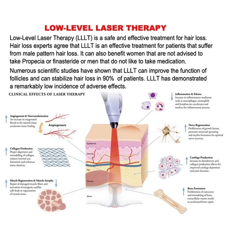 Hair Loss Machine Factory - Laser Regrowth System