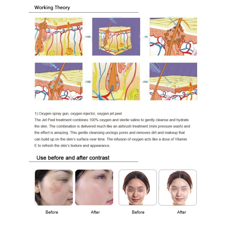 Hydra Machine Manufacturer - Vertical 8in1 Oxygen Facial