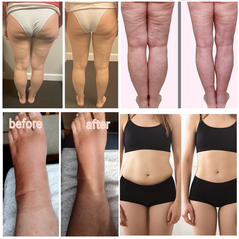 Full Body Massager Supplier - Pressotherapy Drainage Machine