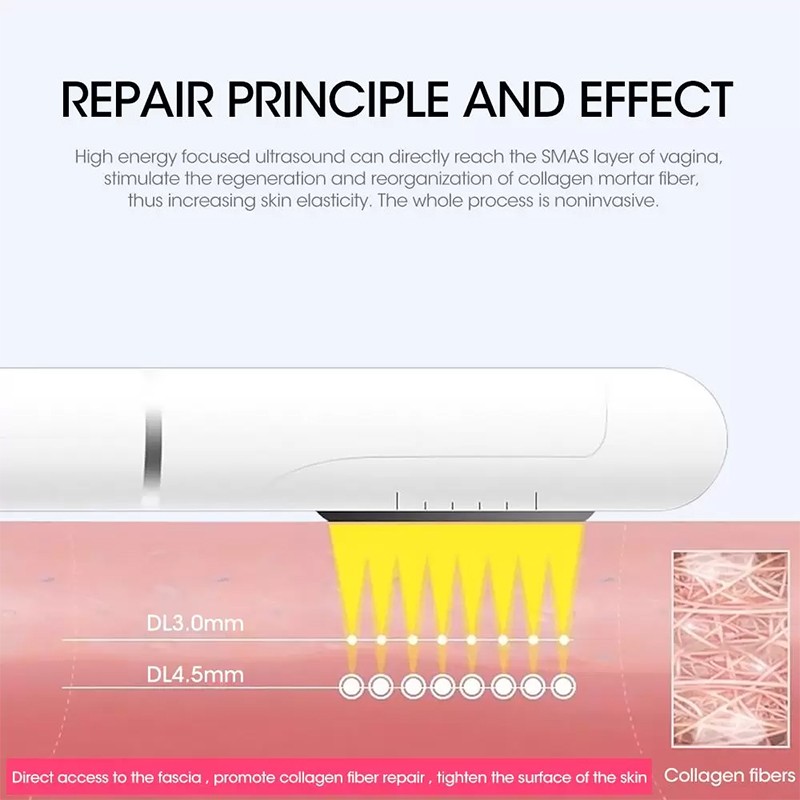 Vaginal Tightening Machine Supplier - Women Anti Aging Device