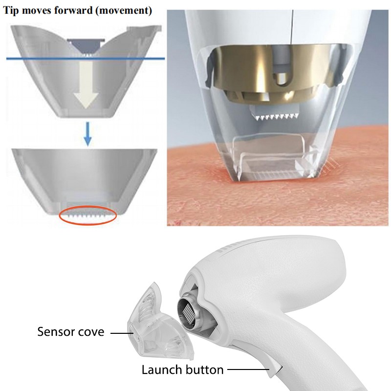 Fractional Therapy Machine Supplier - Heat Based Skin Treatment