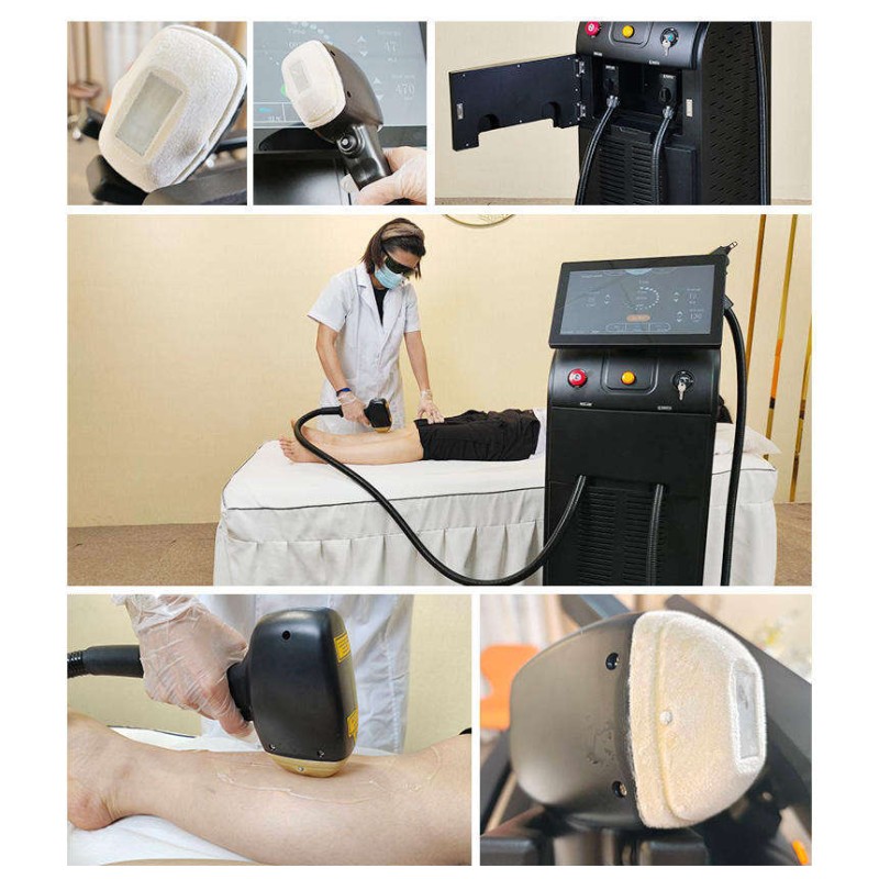 Tattoo Removal Machine Factory - IPL Depiladora Laser