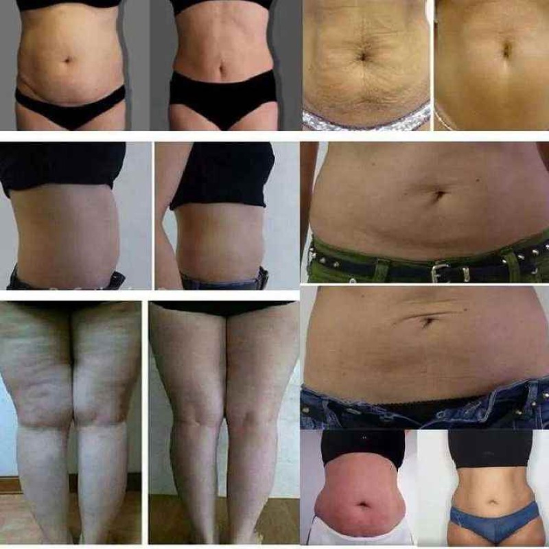 Cryotherapy Machine Factory - Hot Cold Cryo 4.0 Device