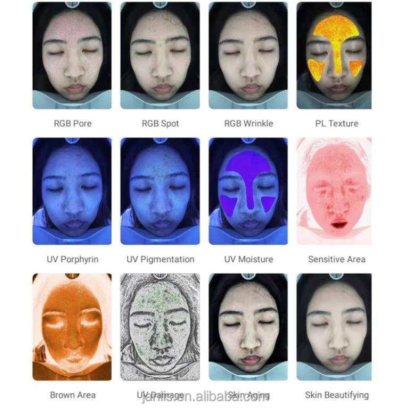 Skin Analyzer Factory - Dermatoscope Facial Scanner