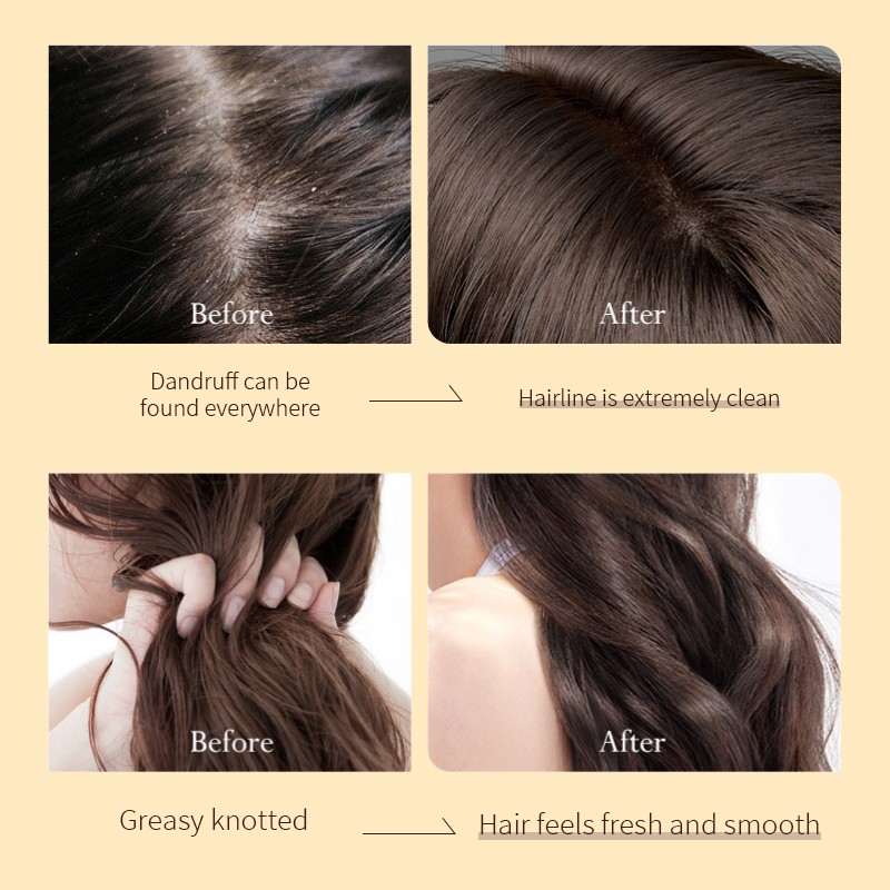 Hair Loss Shampoo Supplier - Biotin Organic Growth Shampoo
