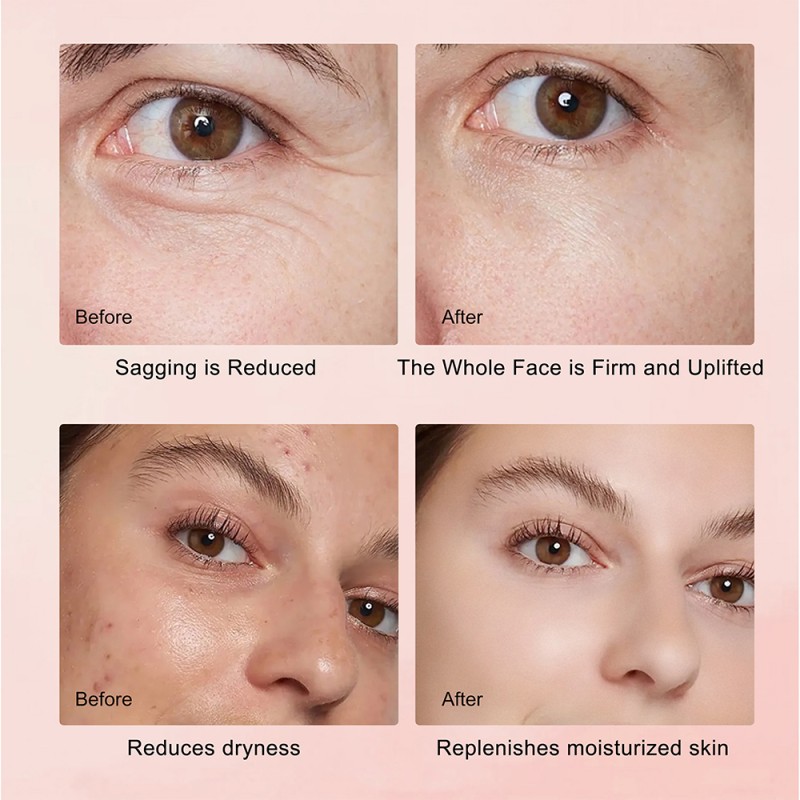 Korean Skincare Set Manufacturer - Ganoderma Firming Lift Kit