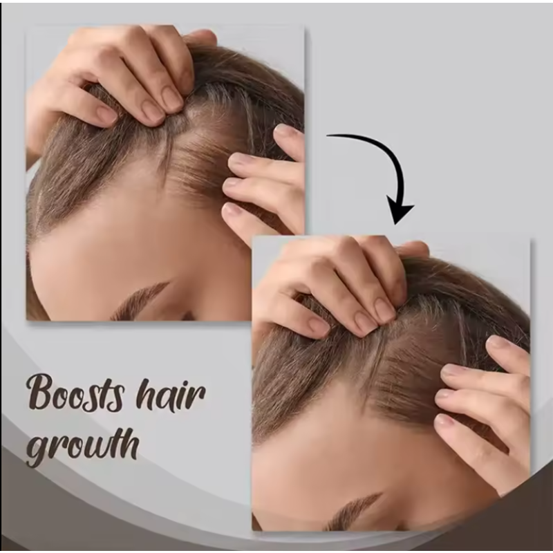 Hair Growth Oil Manufacturer - Rosemary Castor Almond Serum