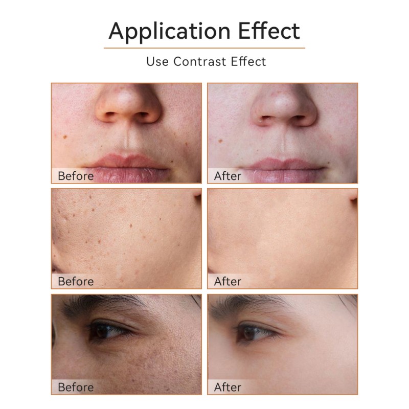 Turmeric Skincare Manufacturer - Private Label Anti Acne Dark Spot Whitening