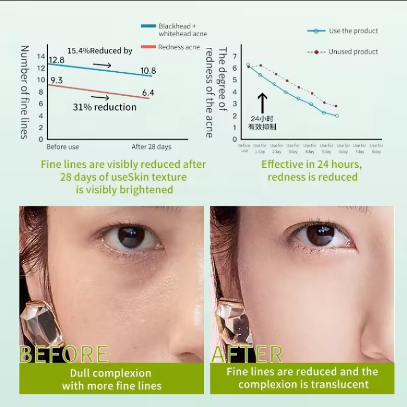 Cordyceps Skincare Supplier - 6pcs Serum Toner Lotion Set