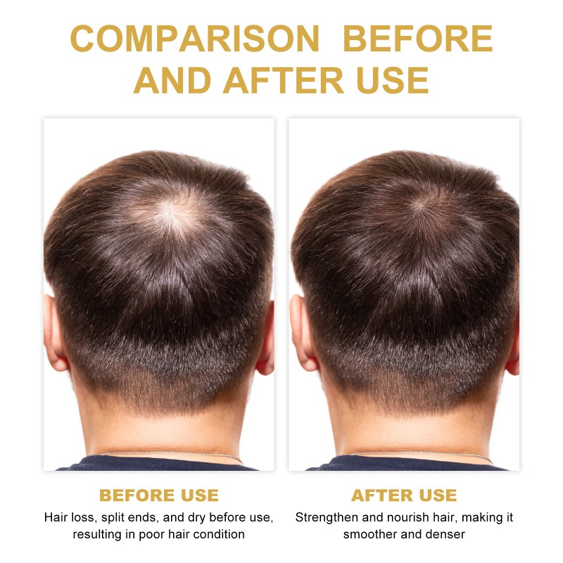 Rosemary Shampoo Manufacturer - Oil Control Fluffy Hair