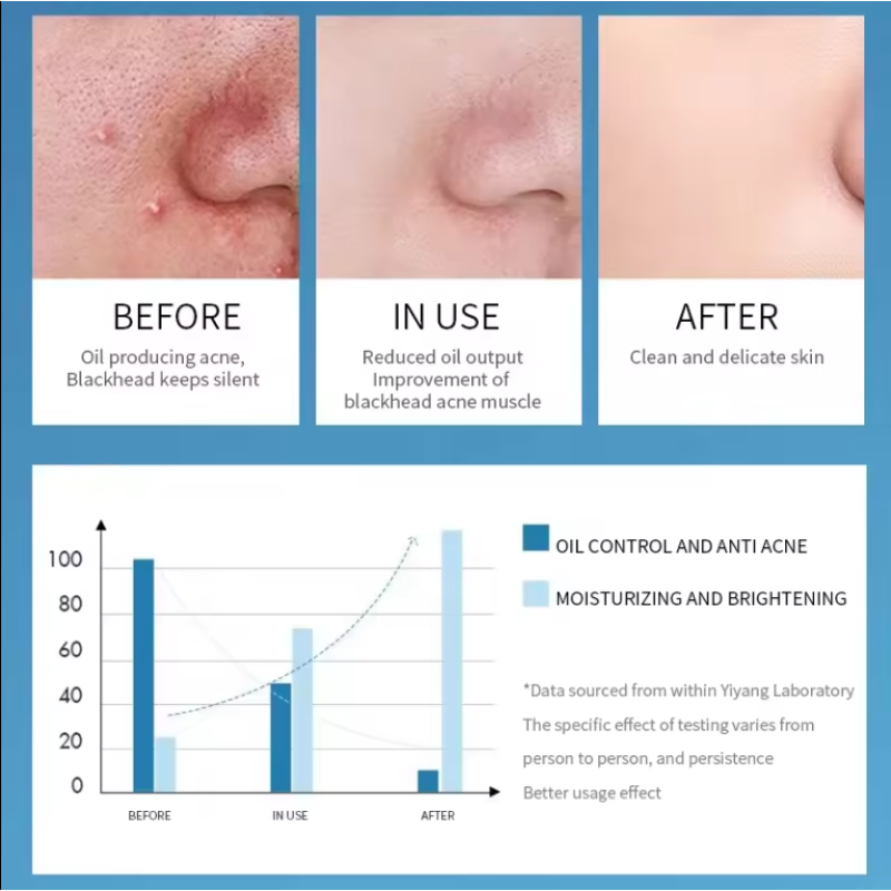 Men's Face Wash Supplier - Soap-free Oil Control Gentle