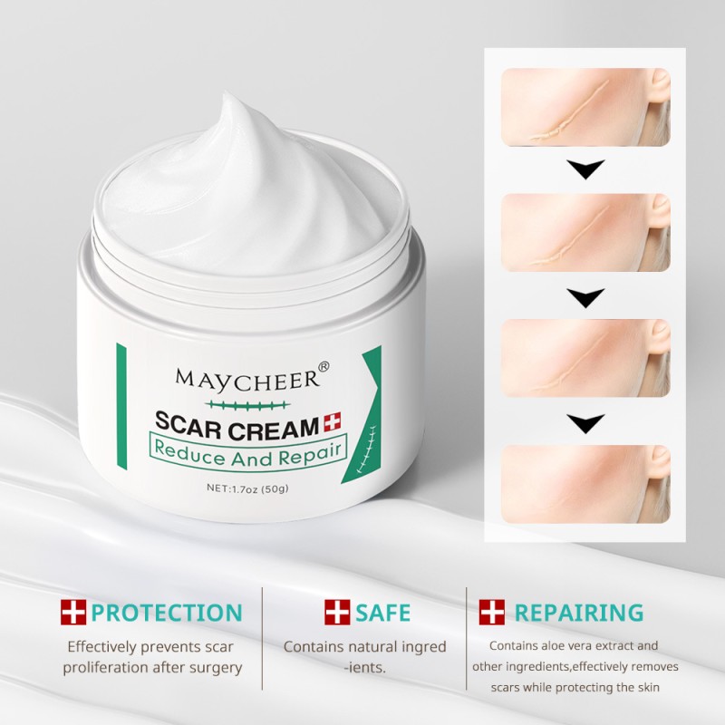 Scar Ointment Manufacturer - Fades Scar Stretch Marks Skin Care Cross-border