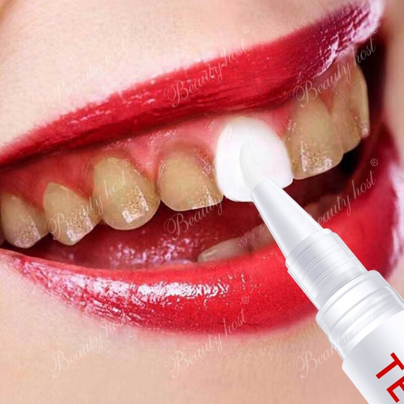 Teeth Whitening Pen Factory - Remove Stains Dental Pen
