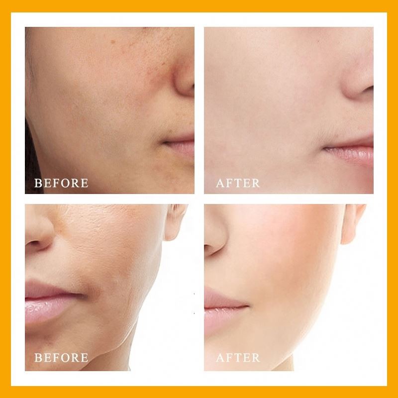 Vitamin C Serum Supplier - Custom Logo Whitening Moisturizing