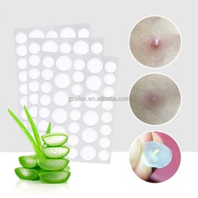 Acne Patch Manufacturer - Natural Plant Extract Waterproof