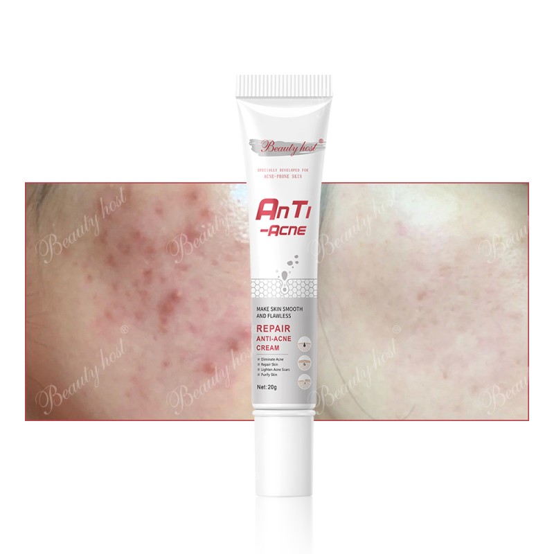 Facial Cream Manufacturer - Dark Spot Anti Acne Lightening
