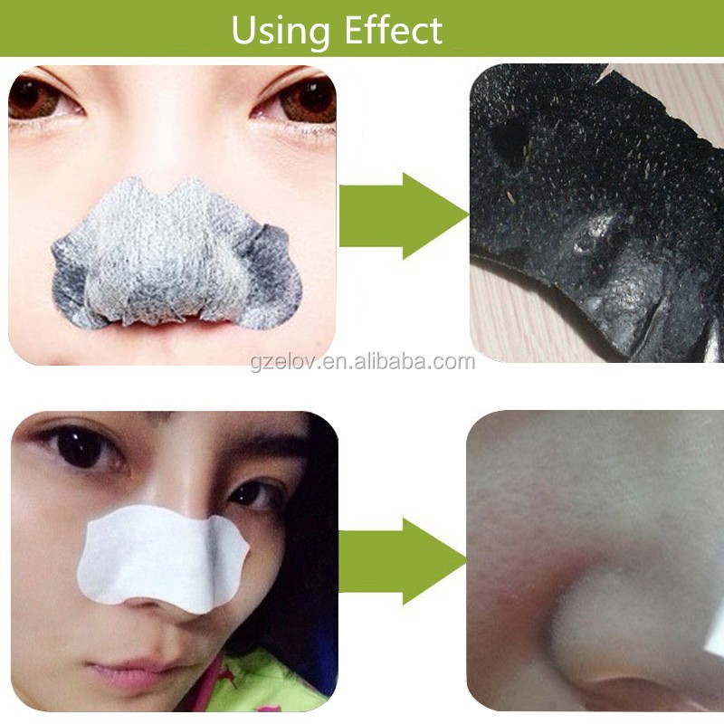 Pore Strips Supplier - Deep Cleaning Blackhead Removal