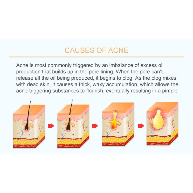 Dead Sea Mud Factory - Aloe Deep Pore Cleansing