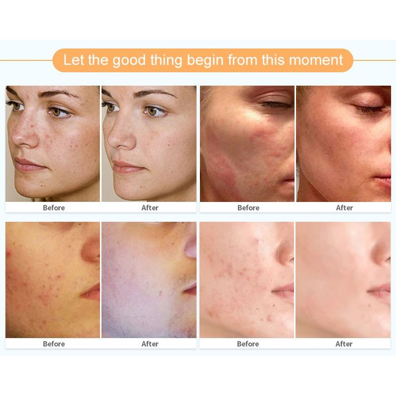 Face Mud Mask Manufacturer - Green Tea Pink Rose Aloe