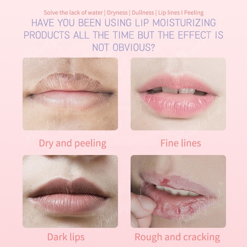 Lip Balm Supplier - Natural Dark Lips Treatment