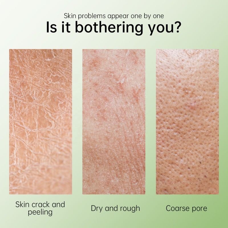 Shea Butter Lotion Manufacturer - Dryness Repair Non Greasy