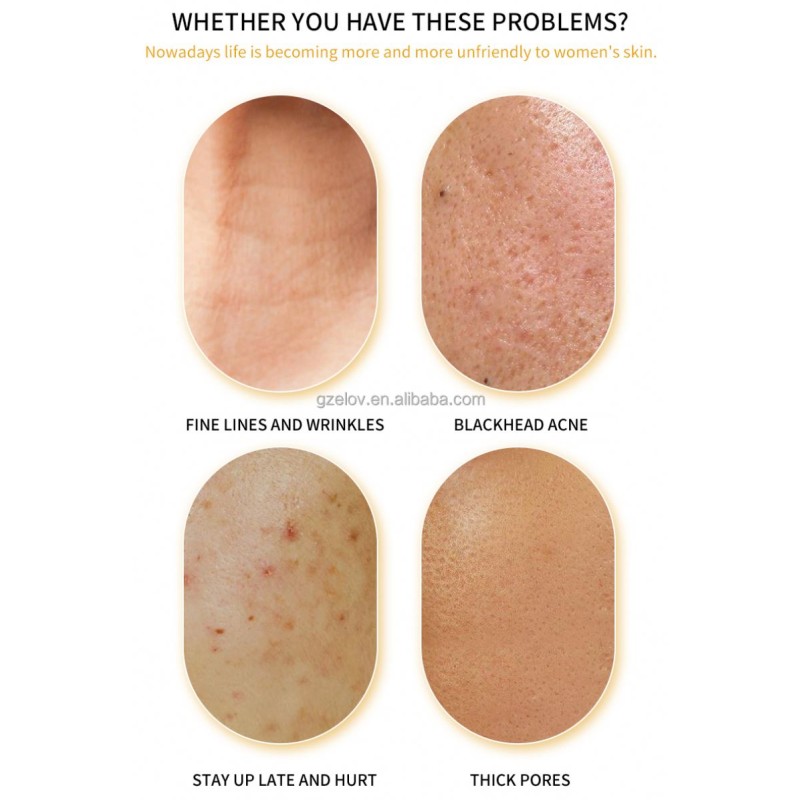 Retinol Face Mask Supplier - Anti-Aging Wrinkle Customizable