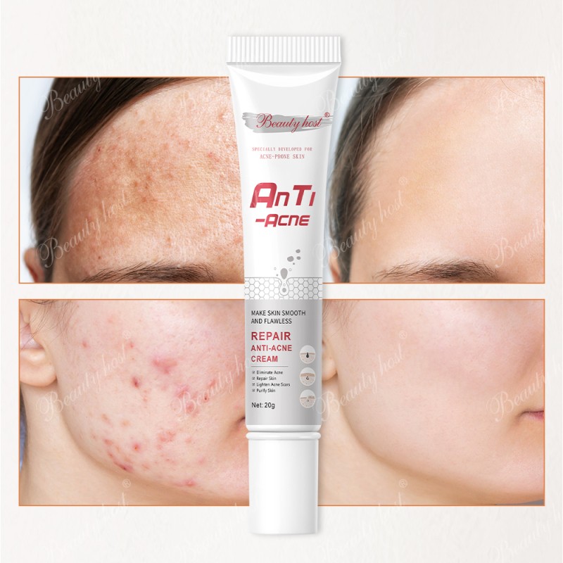 Facial Cream Manufacturer - Dark Spot Anti Acne Lightening