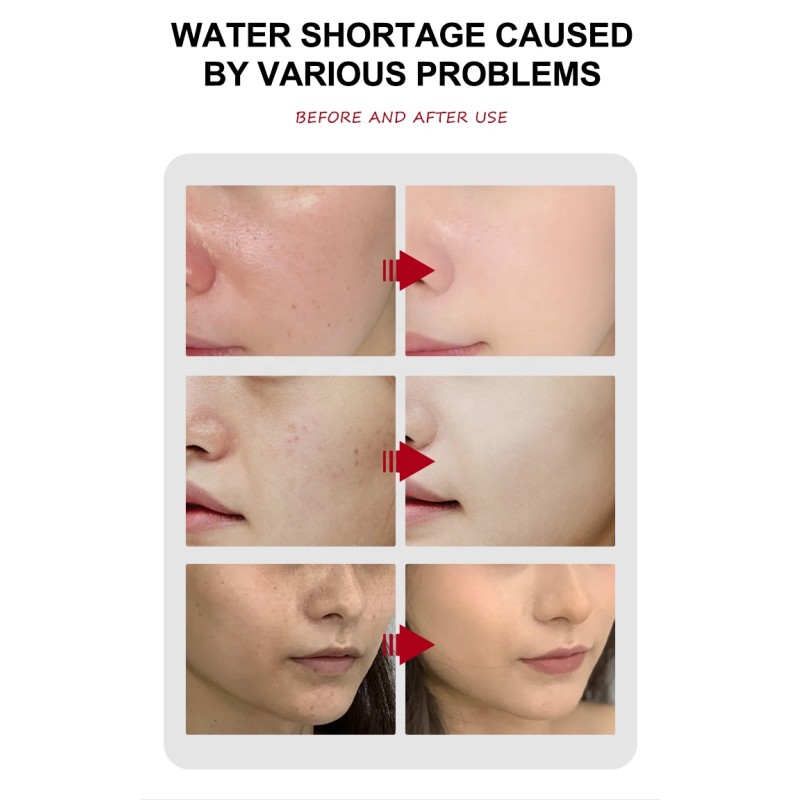 Turmeric Skincare Set Factory - Anti Acne Whitening Serum Scrub