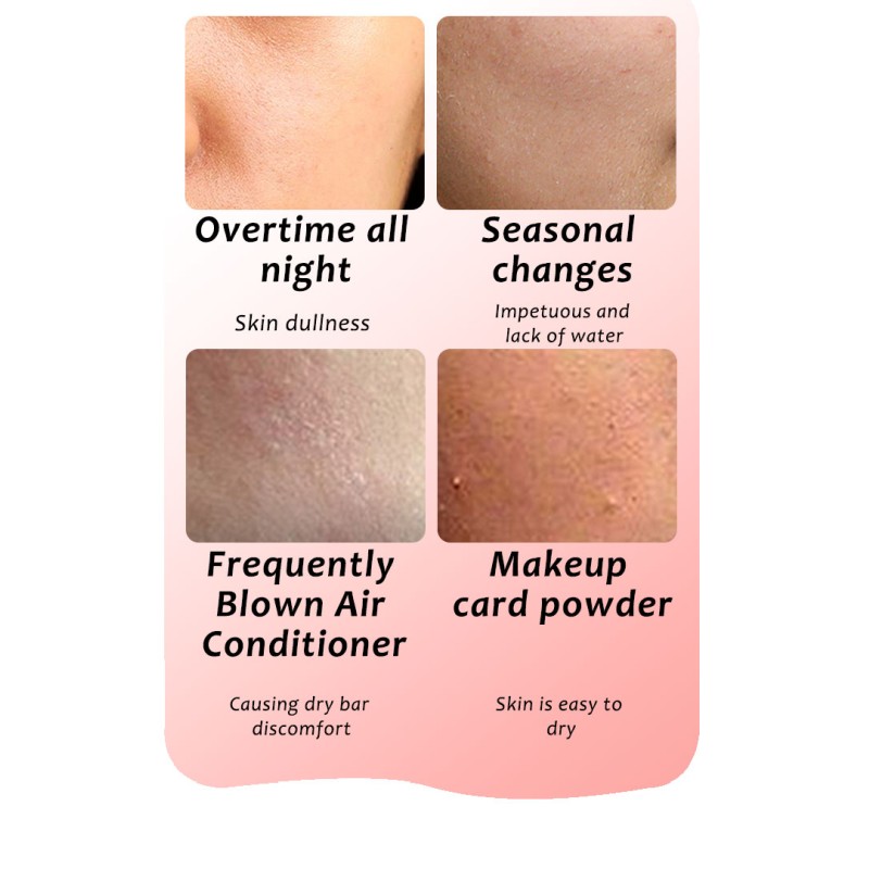 Facial Mask Manufacturer - Bifid Yeast Repair Hyaluronic Acid