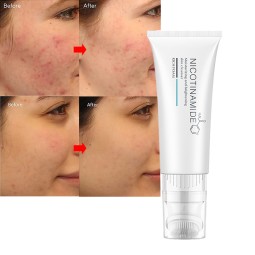 Face Cleanser Factory - Exfoliating Acne Treatment Niacinamide Amino Acid