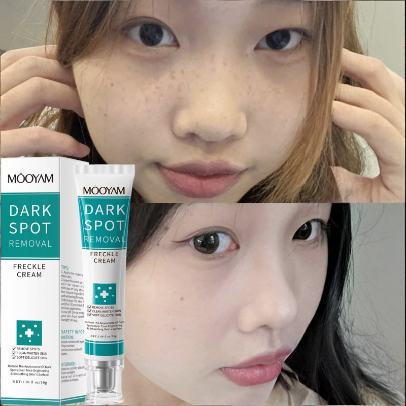 Freckle Cream Factory - Organic Dark Spot Removal Whitening Brighten
