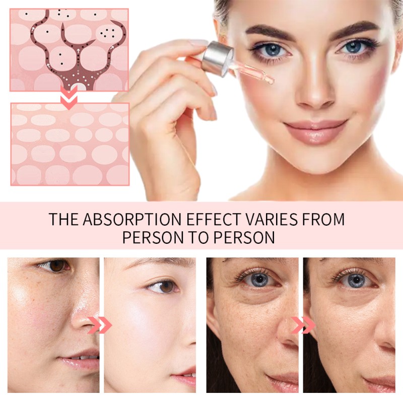 Vitamin C Serum Manufacturer - 5-in-1 Brightening Moisturizing Firming