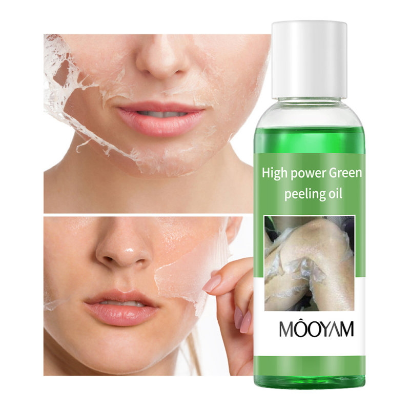 Peeling Oil Supplier - Aloe Vera Emu Oil Whitening Exfoliating